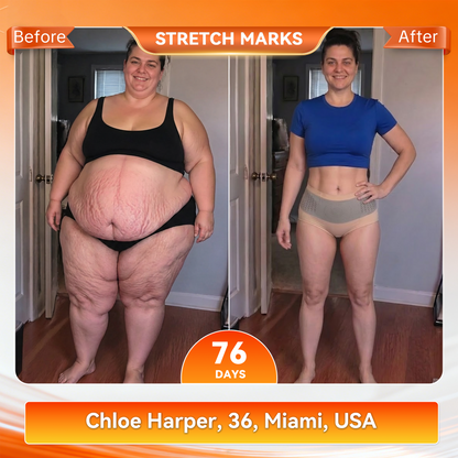 𝐎𝐟𝐟𝐢𝐜𝐢𝐚𝐥 𝐒𝐭𝐨𝐫𝐞 🇺🇸| 👩‍⚕️ 𝐂𝐥𝐞𝐚𝐫𝐞𝐧𝐚® 𝟐𝟎𝟐𝟔 𝐌𝐨𝐫𝐢𝐧𝐠𝐚 x 𝐁𝐞𝐫𝐛𝐞𝐫𝐢𝐧𝐞 x 𝐍𝐀𝐃+ 𝟔-𝐈𝐧-𝟏 𝐌𝐢𝐜𝐫𝐨-𝐏𝐚𝐫𝐭𝐢𝐜𝐥𝐞 𝐒𝐜𝐮𝐥𝐩𝐭𝐢𝐧𝐠 & 𝐅𝐚𝐭-𝐁𝐮𝐫𝐧 𝐒𝐡𝐨𝐫𝐭𝐬 (Women + Men with Enhanced Male Vitality Blend)